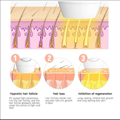 IPL Laser Hair Removal - Black_4